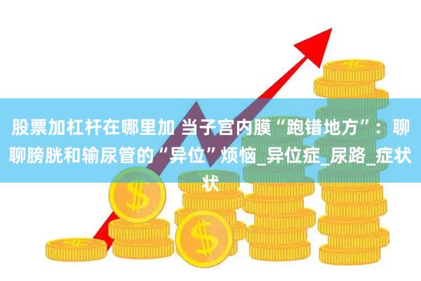 股票加杠杆在哪里加 当子宫内膜“跑错地方”：聊聊膀胱和输尿管的“异位”烦恼_异位症_尿路_症状